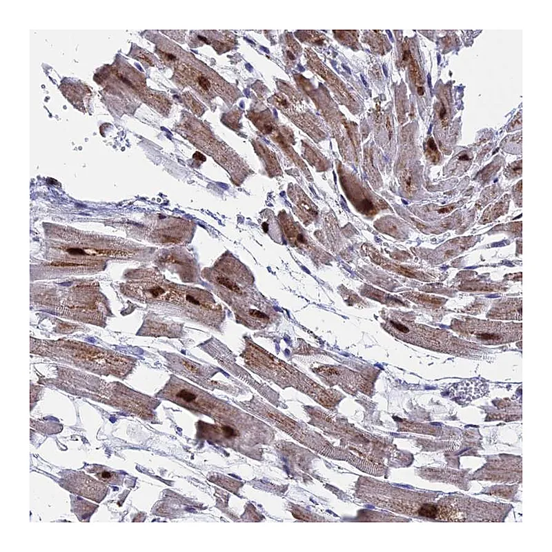 Atlas Antibodies Anti-WDR83 Antibody