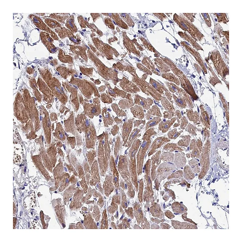 Atlas Antibodies Anti-WDR83 Antibody