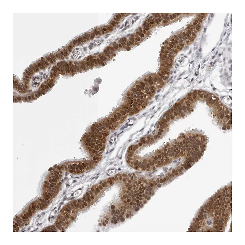 Atlas Antibodies Anti-WDR77 Antibody