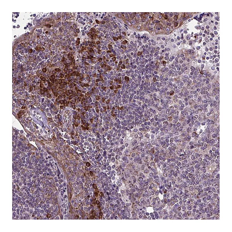 Atlas Antibodies Anti-WDR83OS Antibody
