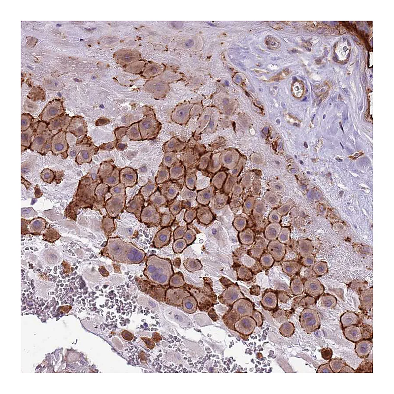 Atlas Antibodies Anti-WDR90 Antibody