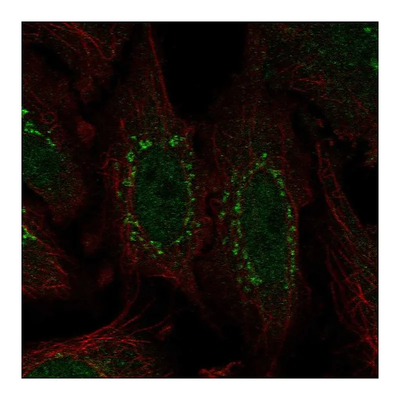 Atlas Antibodies Anti-WDR88 Antibody