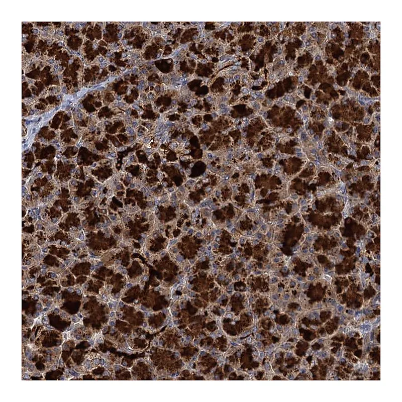 Atlas Antibodies Anti-WDR88 Antibody