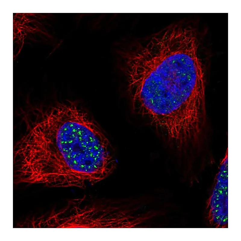 Atlas Antibodies Anti-WDR90 Antibody