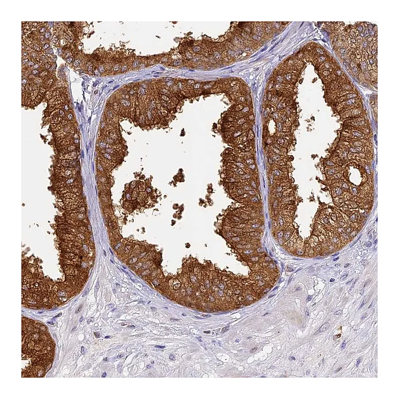Atlas Antibodies Anti-WDR92 Antibody