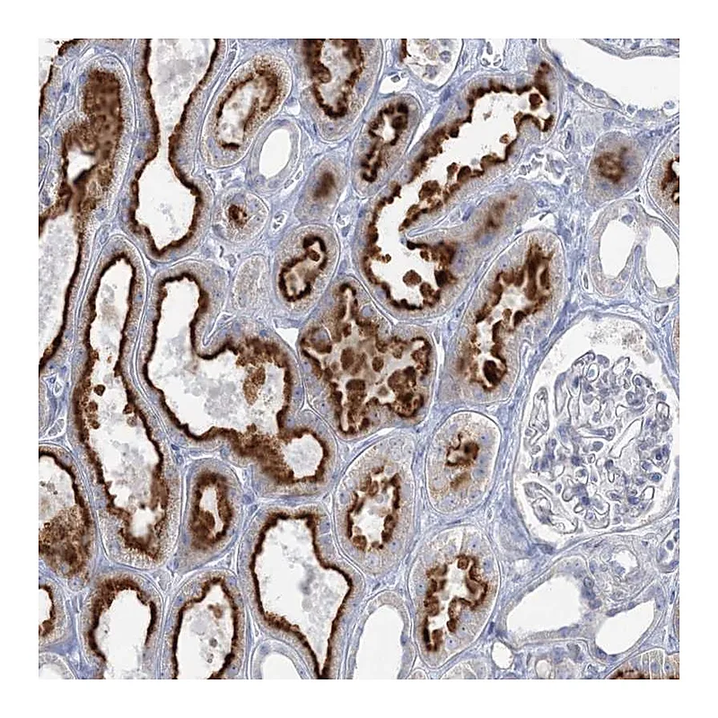 Atlas Antibodies Anti-WDSUB1 Antibody