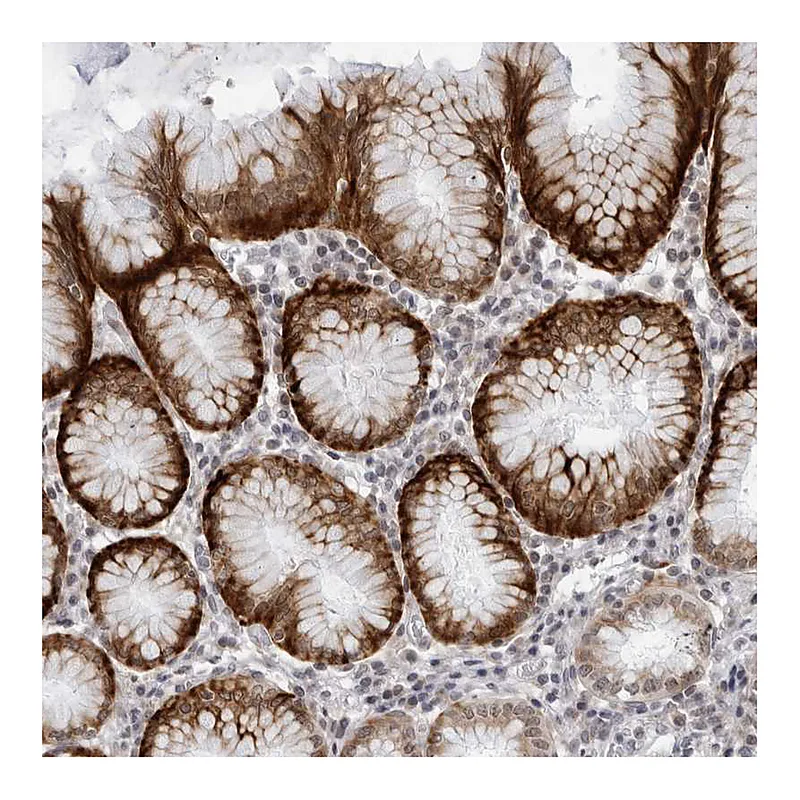 Atlas Antibodies Anti-WDTC1 Antibody
