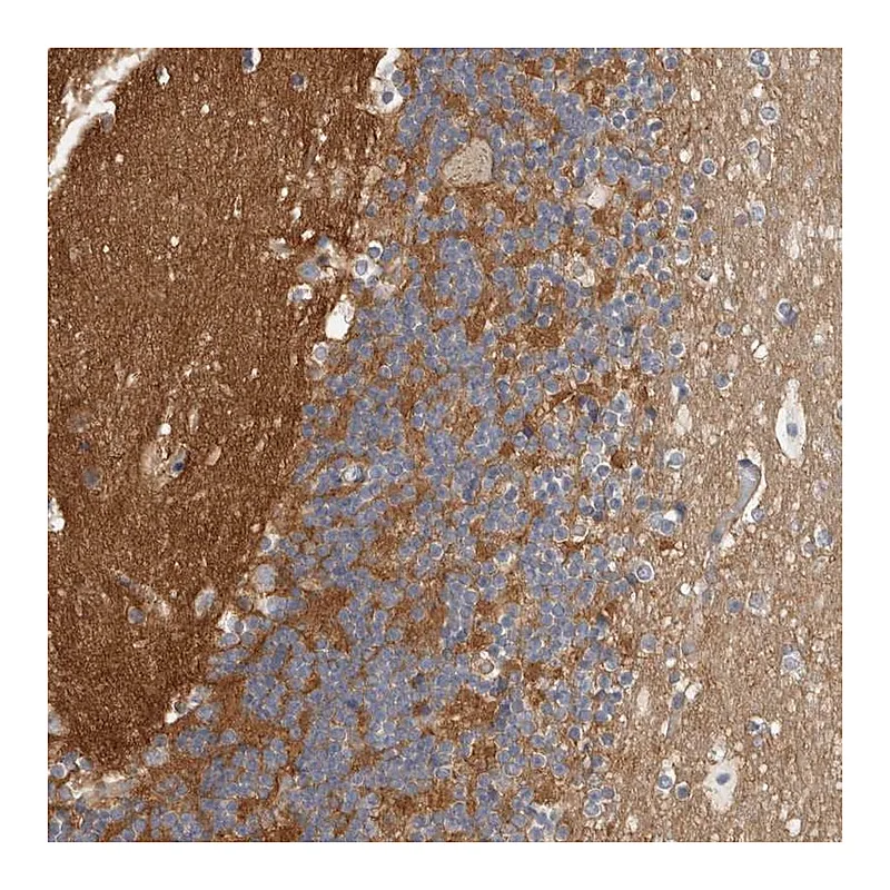 Atlas Antibodies Anti-WDTC1 Antibody