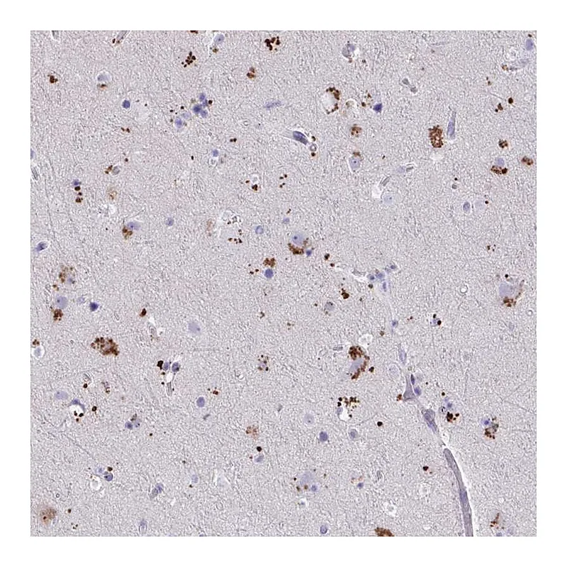Atlas Antibodies Anti-WDR97 Antibody