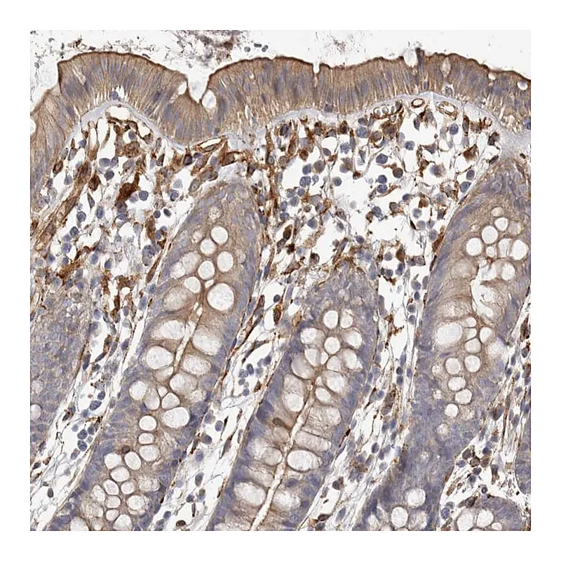 Atlas Antibodies Anti-WDTC1 Antibody