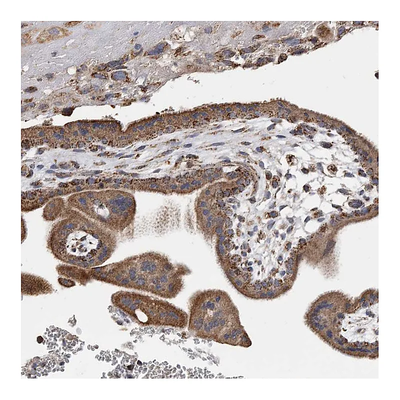 Atlas Antibodies Anti-WFDC1 Antibody
