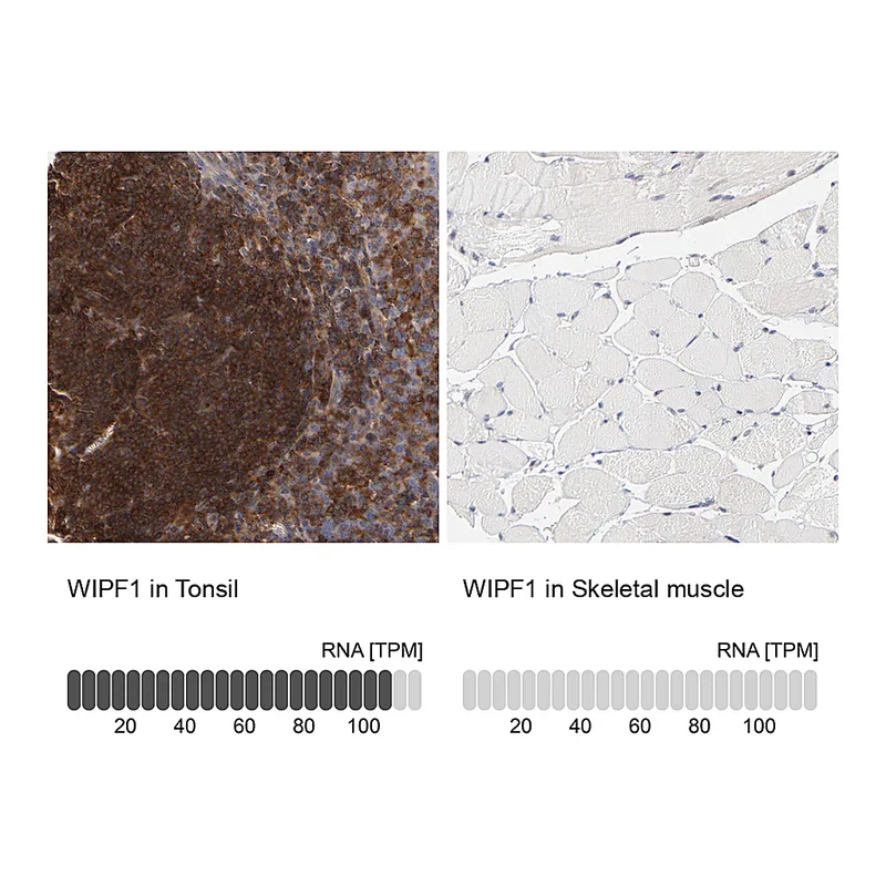 Atlas Antibodies Anti-WIPF1 Antibody