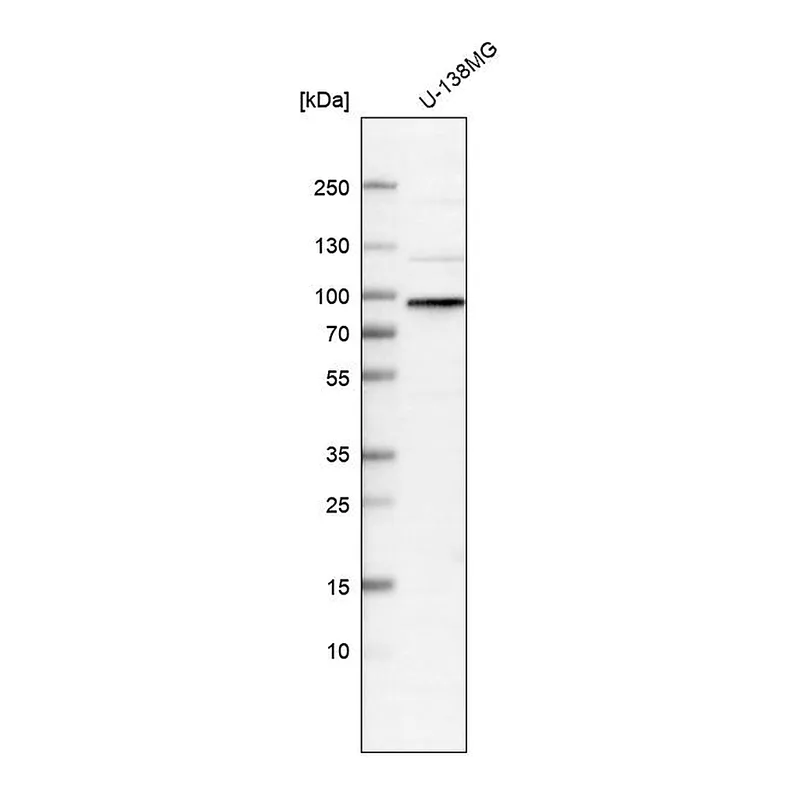Atlas Antibodies Anti-WHAMM Antibody