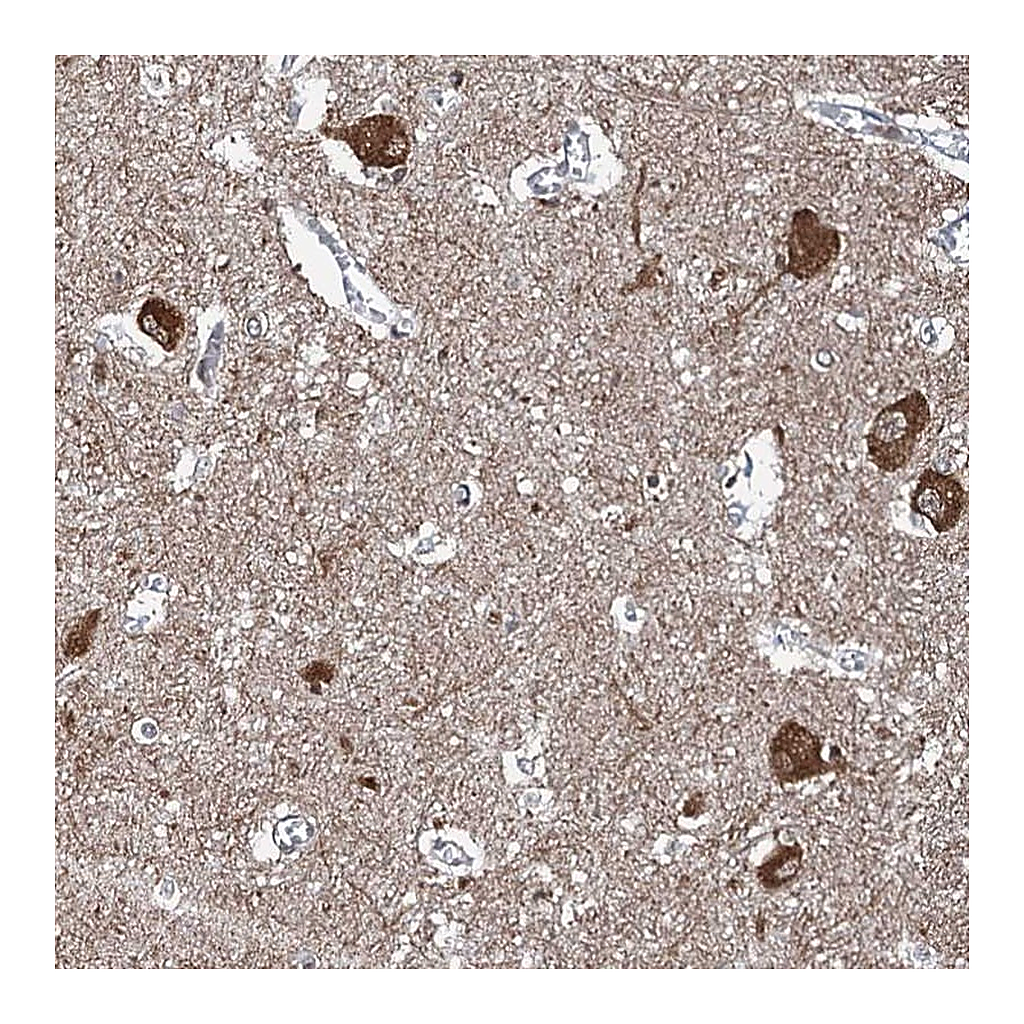 Atlas Antibodies Anti-WHAMM Antibody