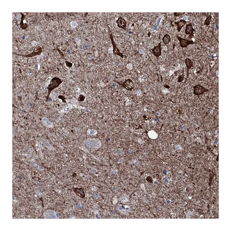 Atlas Antibodies Anti-WIPF3 Antibody