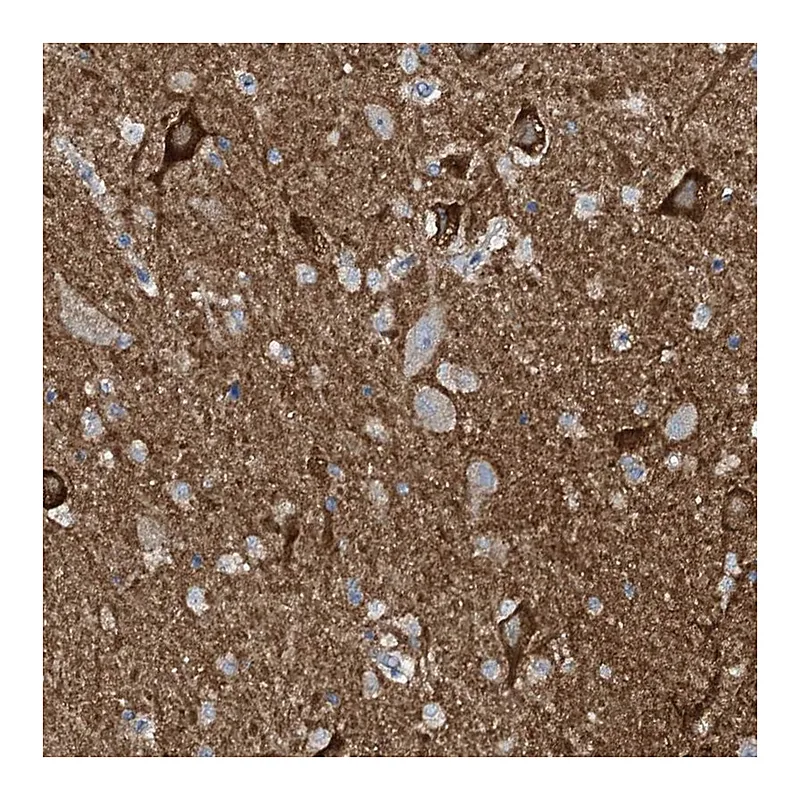 Atlas Antibodies Anti-WIPF3 Antibody