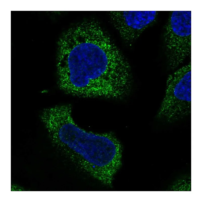 Atlas Antibodies Anti-WISP3 Antibody