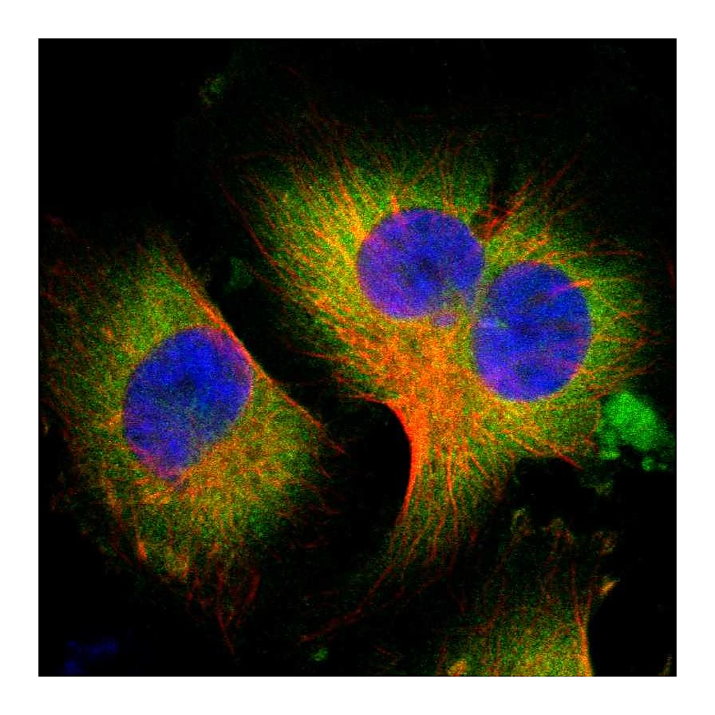 Atlas Antibodies Anti-WISP1 Antibody