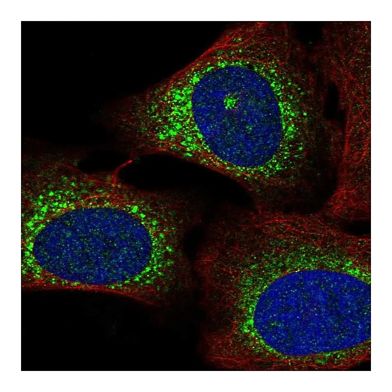 Atlas Antibodies Anti-WISP3 Antibody