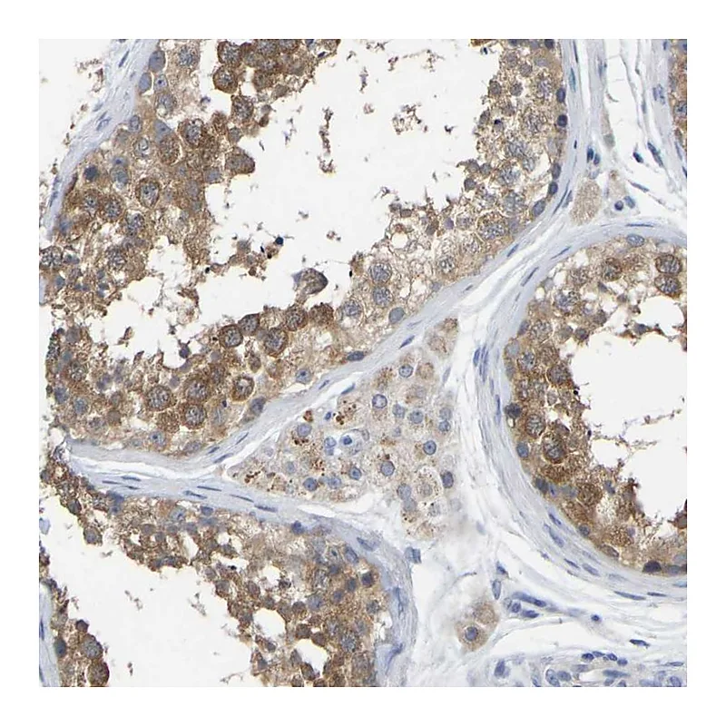 Atlas Antibodies Anti-WIPI2 Antibody