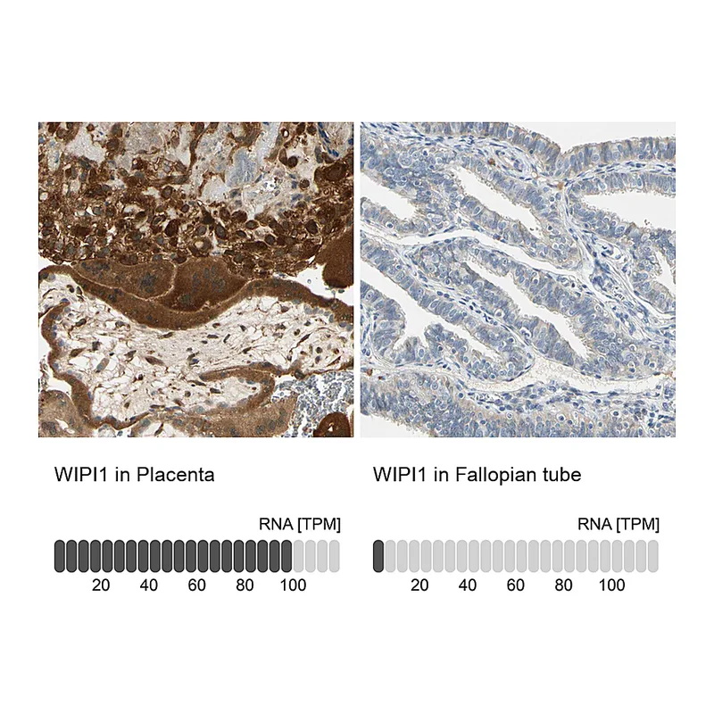 Atlas Antibodies Anti-WIPI1 Antibody