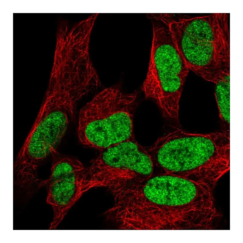 Atlas Antibodies Anti-WIZ Antibody