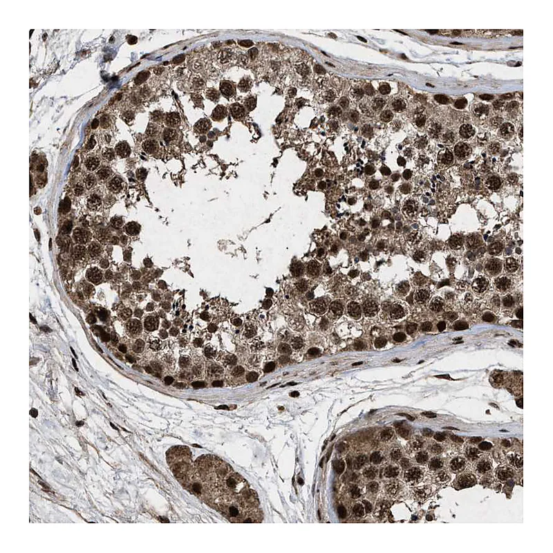 Atlas Antibodies Anti-WIZ Antibody