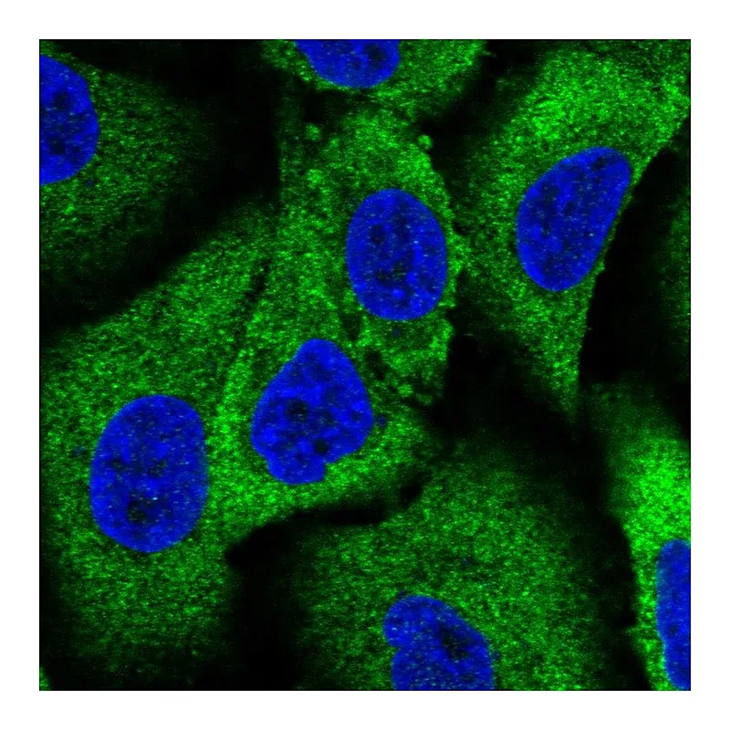 Atlas Antibodies Anti-WNK1 Antibody