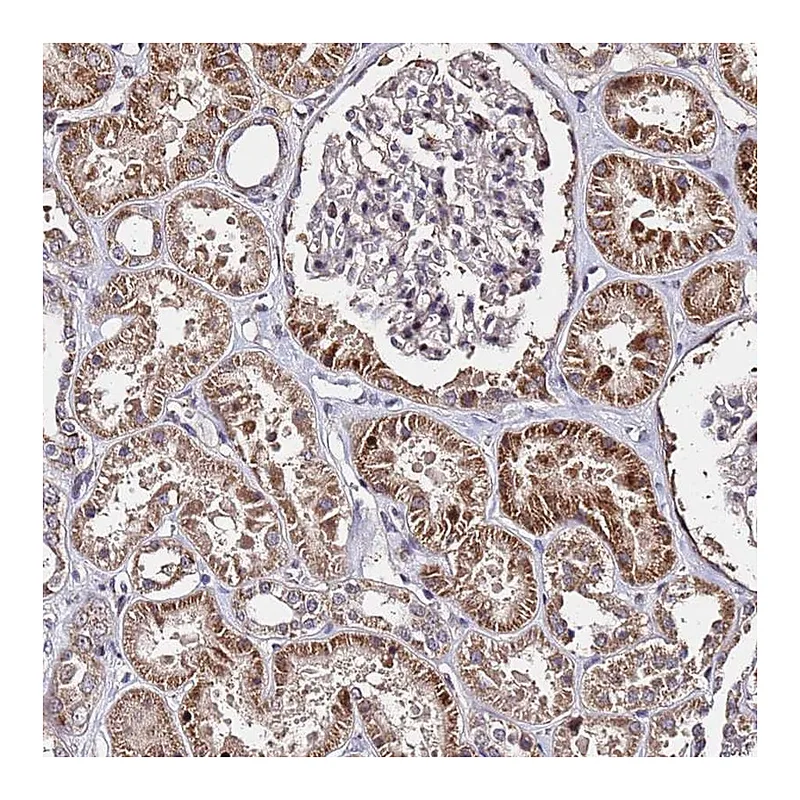 Atlas Antibodies Anti-WNK4 Antibody