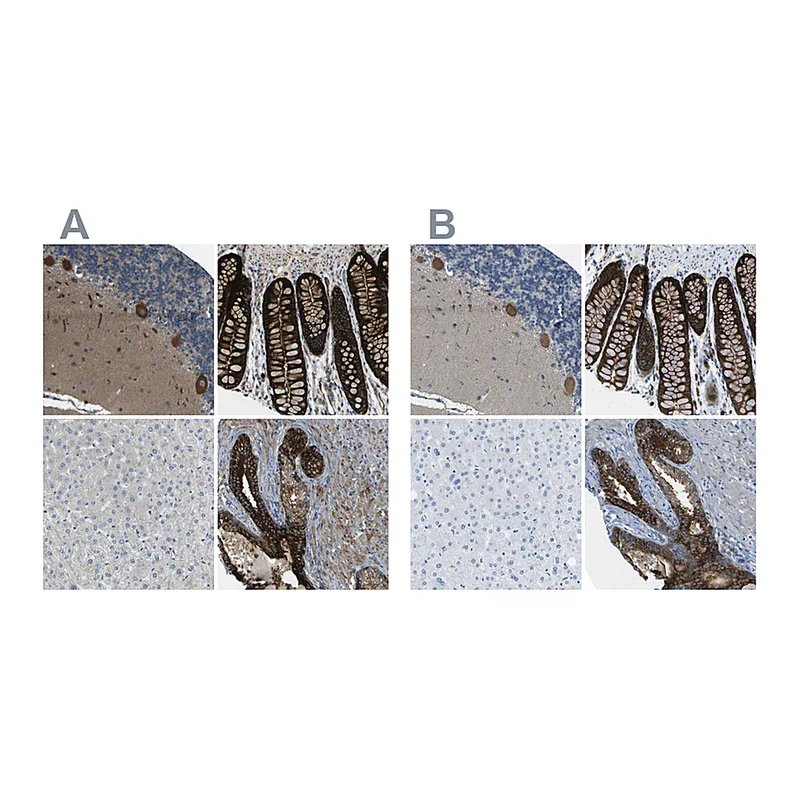 Atlas Antibodies Anti-WNK2 Antibody