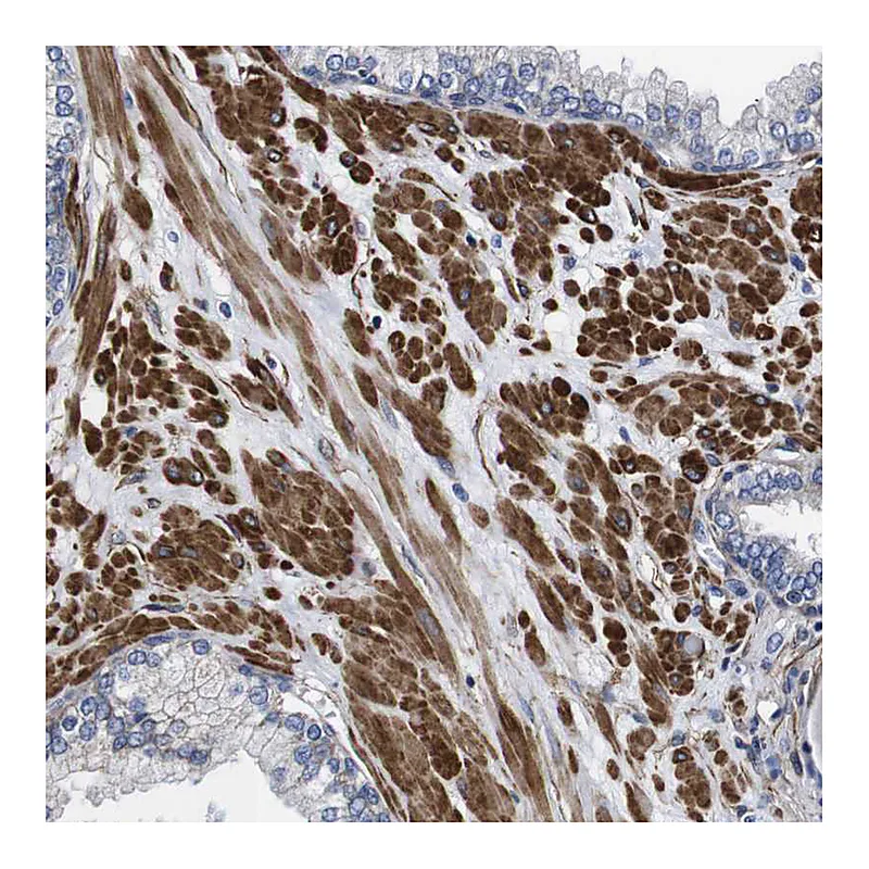 Atlas Antibodies Anti-WNT10A Antibody