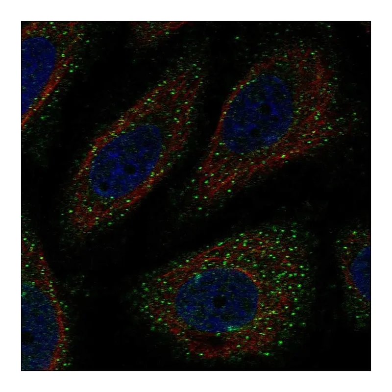 Atlas Antibodies Anti-WNK3 Antibody