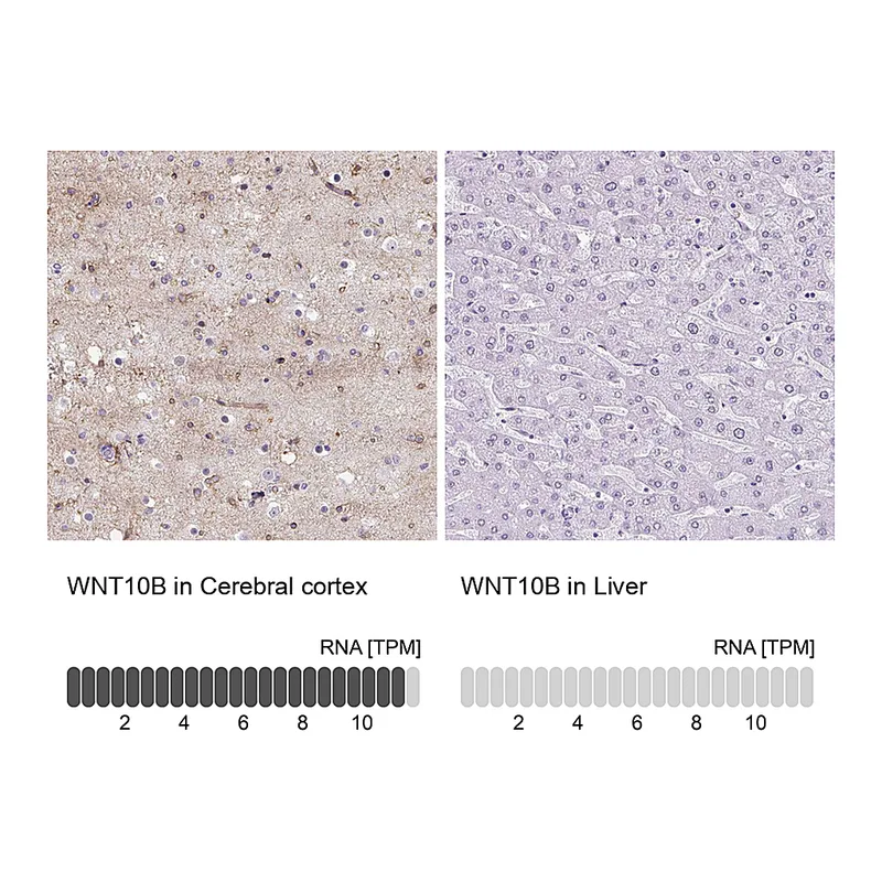 Atlas Antibodies Anti-WNT10B Antibody