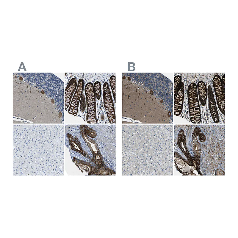 Atlas Antibodies Anti-WNK2 Antibody