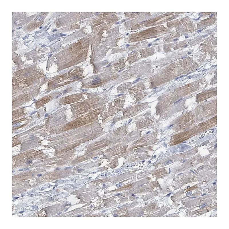 Atlas Antibodies Anti-WNT11 Antibody
