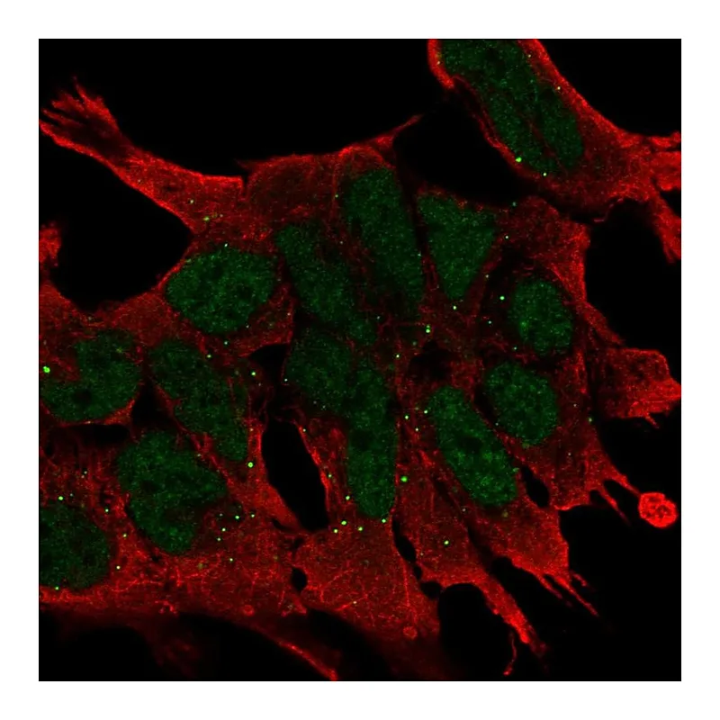 Atlas Antibodies Anti-WNT2B Antibody
