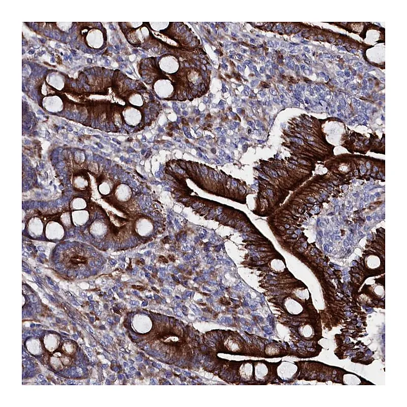 Atlas Antibodies Anti-WNT8A Antibody