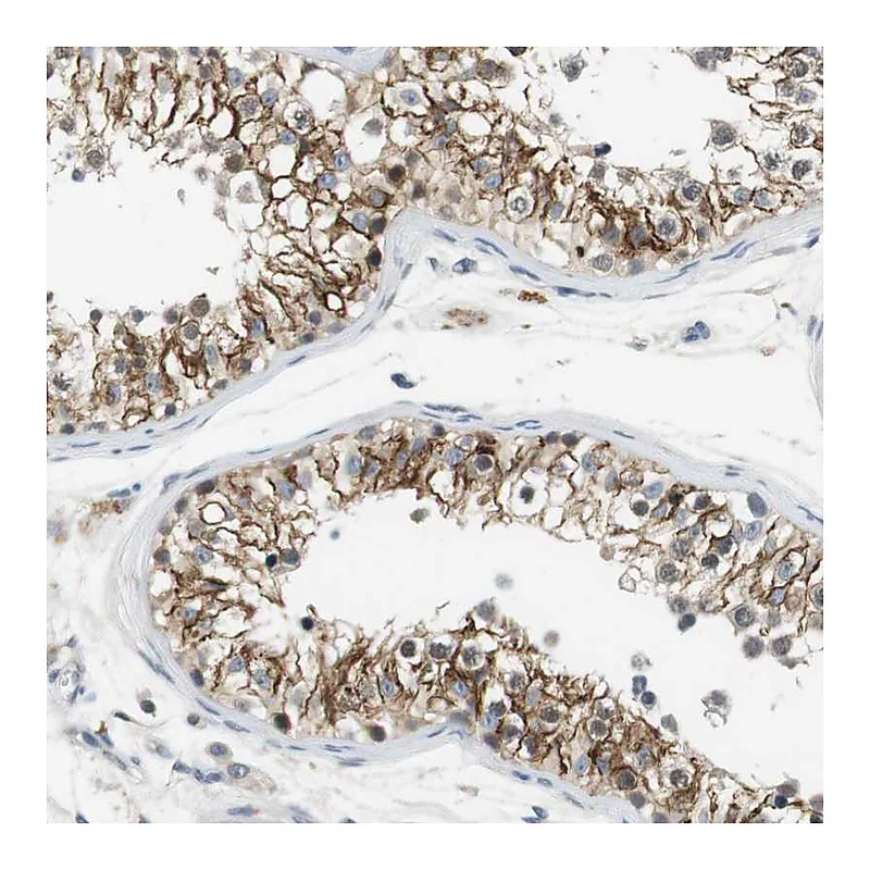 Atlas Antibodies Anti-WNT7A Antibody