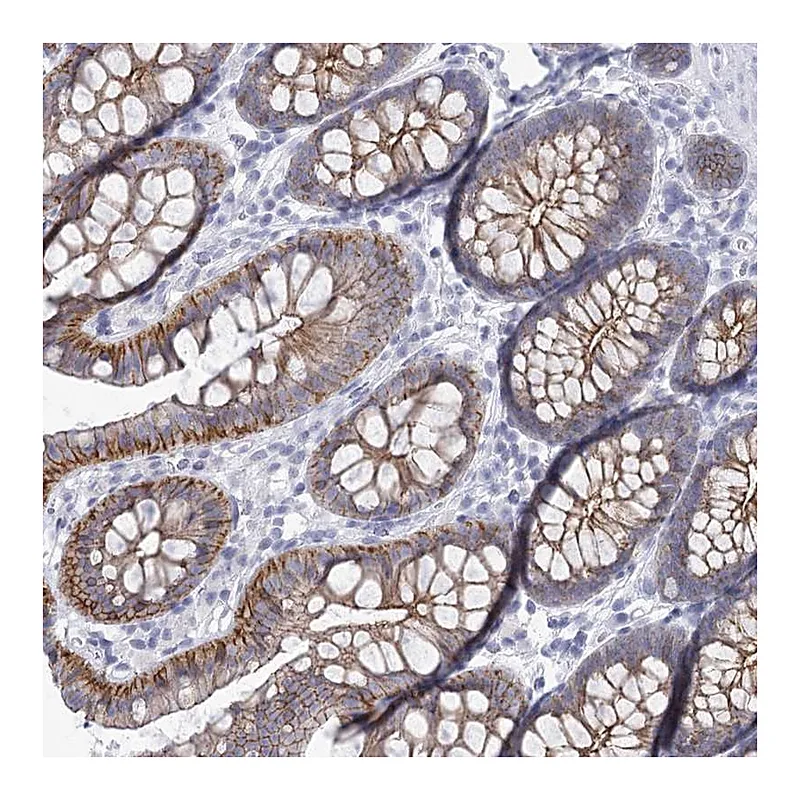 Atlas Antibodies Anti-WNT8B Antibody