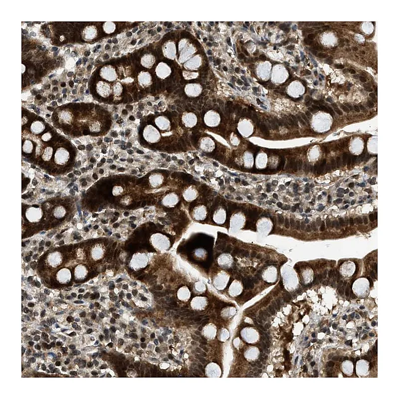 Atlas Antibodies Anti-WRB Antibody