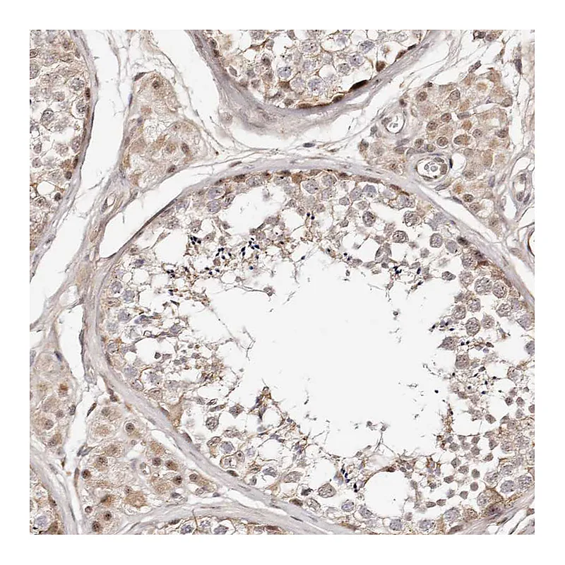 Atlas Antibodies Anti-WRN Antibody