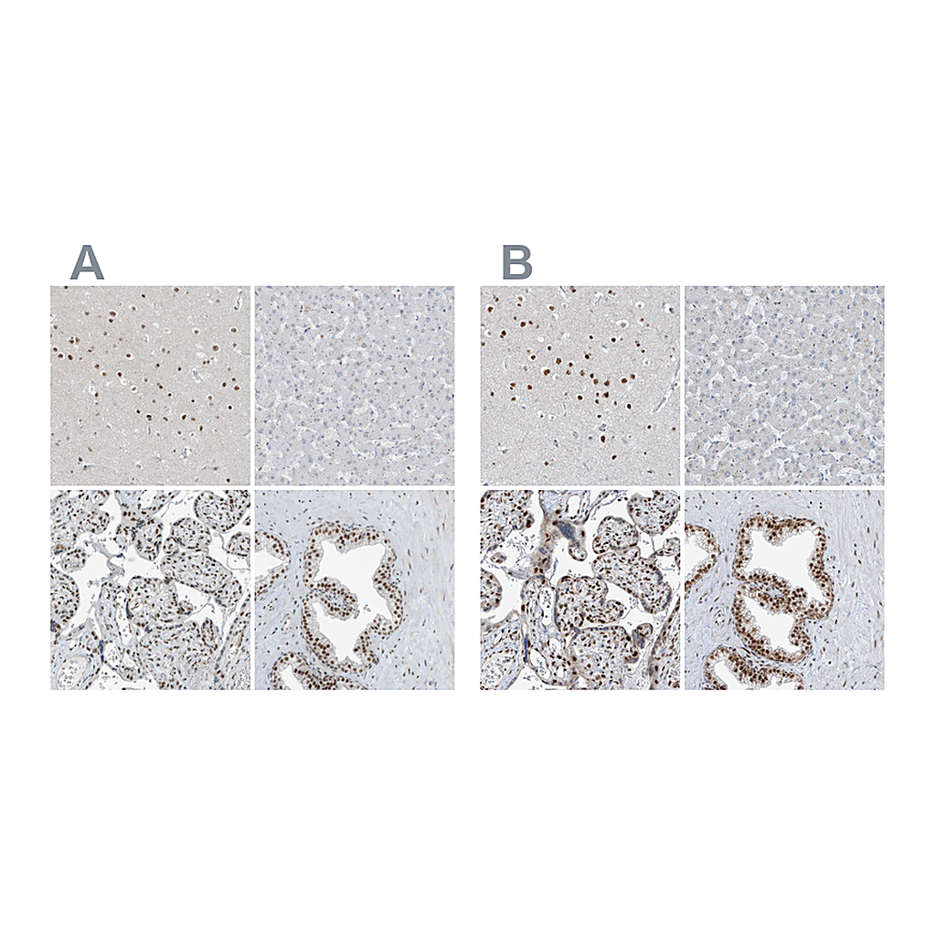 Atlas Antibodies Anti-WRNIP1 Antibody
