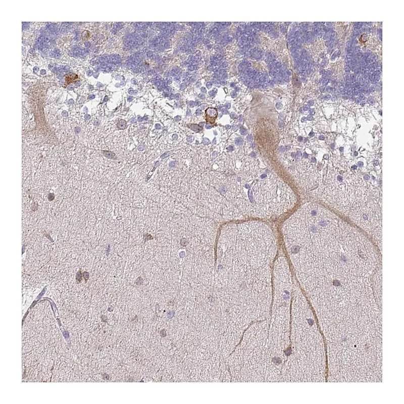 Atlas Antibodies Anti-WSB2 Antibody