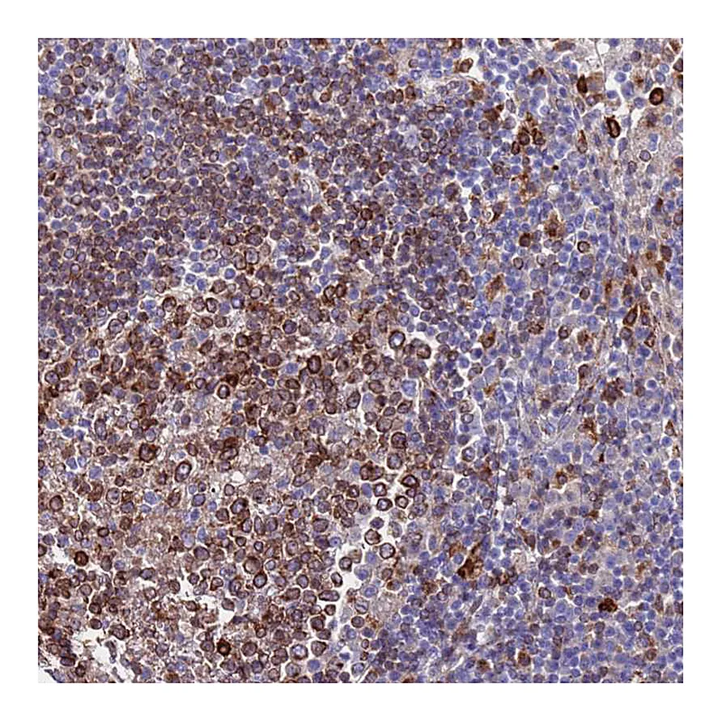 Atlas Antibodies Anti-GREB1L Antibody