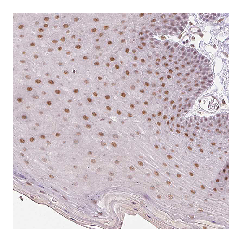 Atlas Antibodies Anti-GRHL3 Antibody