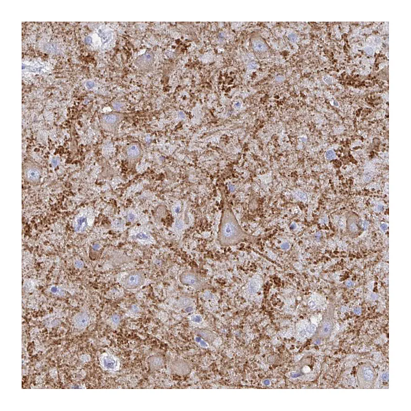 Atlas Antibodies Anti-GRIA1 Antibody