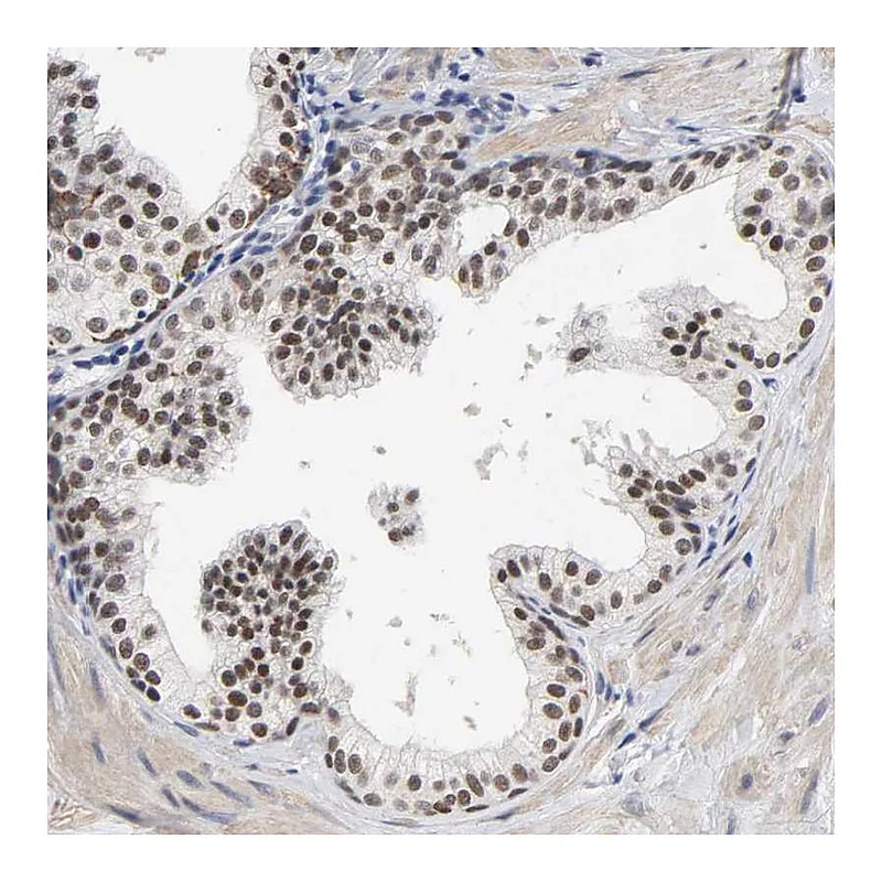 Atlas Antibodies Anti-GRHL2 Antibody