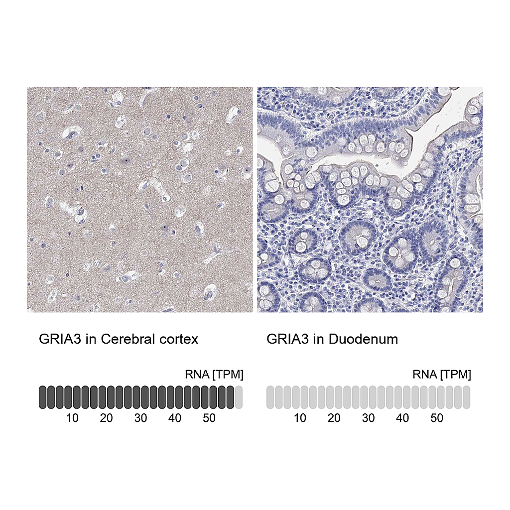 Atlas Antibodies Anti-GRIA3 Antibody