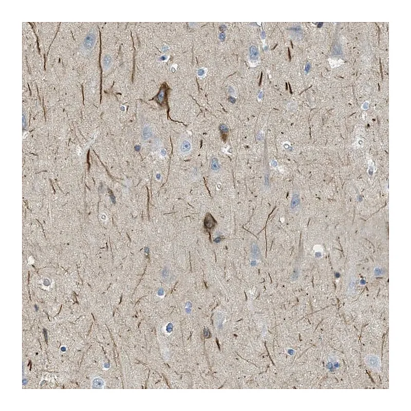Atlas Antibodies Anti-GRIK2 Antibody