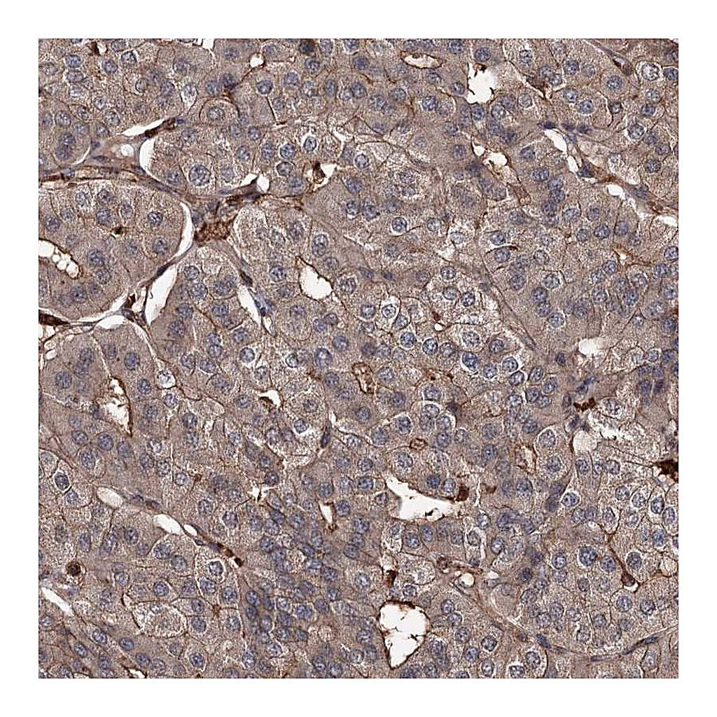Atlas Antibodies Anti-GRIP1 Antibody